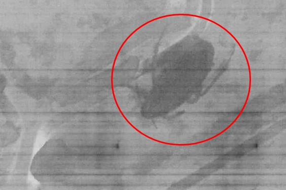 Ada kecoak di sajian kari domba, restoran ini digugat Rp 134 juta