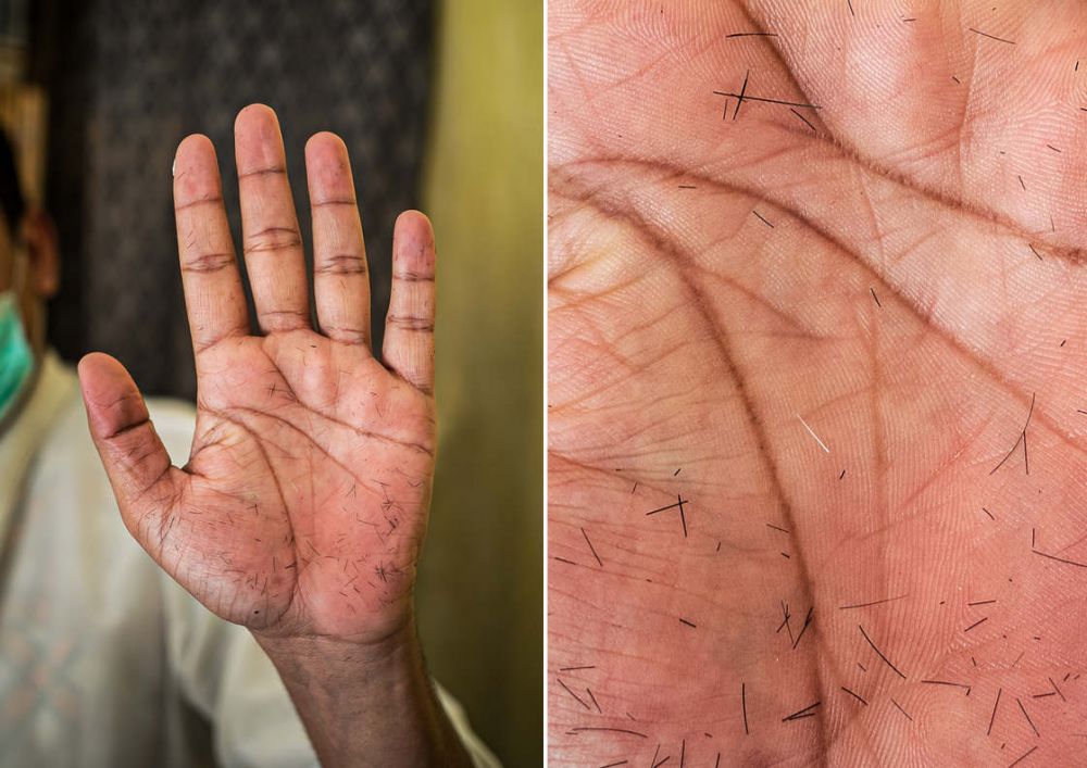 13 Foto telapak tangan pekerja ini bukti kerasnya membanting tulang