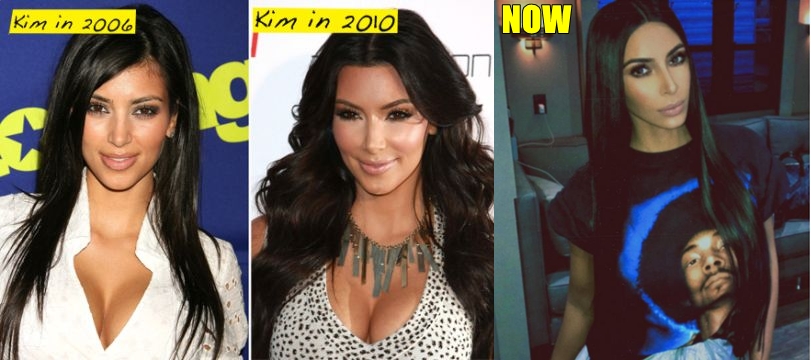 8 Foto Kardashian bersaudara sebelum & sesudah oplas, pangling banget