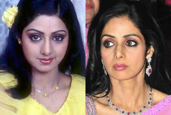 7 Seleb Bollywood ini lakukan oplas, hasilnya malah bikin kaget
