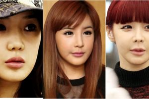 5 Seleb Korea yang wajahnya malah jadi aneh setelah oplas, gagal ya?