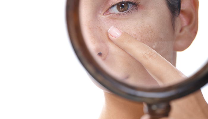 9 Mitos tentang kulit yang nggak perlu kamu percayai lagi, apa aja ya?