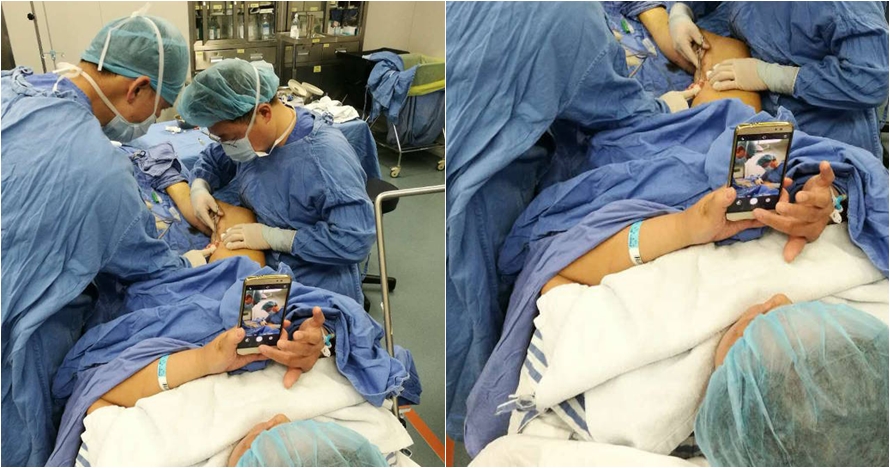 Kaki sedang dioperasi, wanita ini malah merekamnya live di medsos
