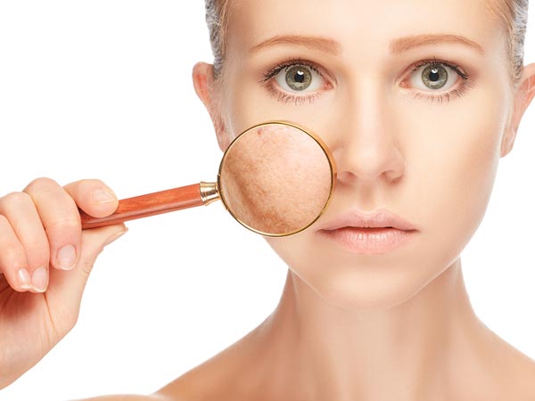 7 Tips yang harus kamu tahu kalau punya kulit sensitif, apa aja ya?