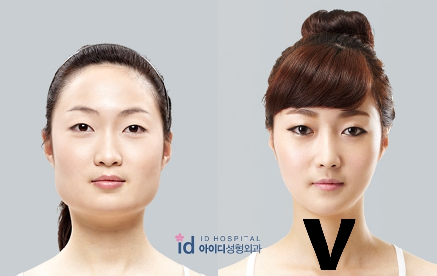 Cewek Korea terobsesi dengan 9 standar kecantikan ini, ada-ada aja deh
