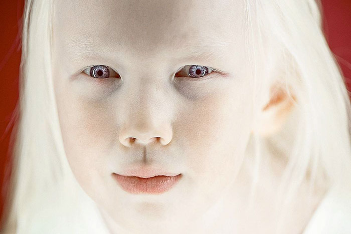 12 Potret Nariyana, gadis albino yang curi perhatian dunia modeling