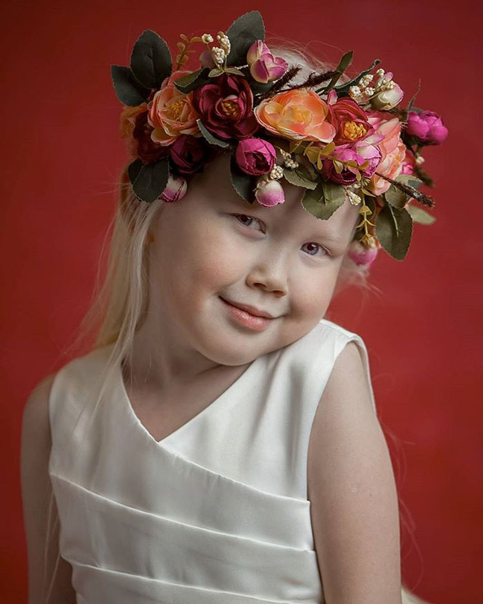 12 Potret Nariyana, gadis albino yang curi perhatian dunia modeling