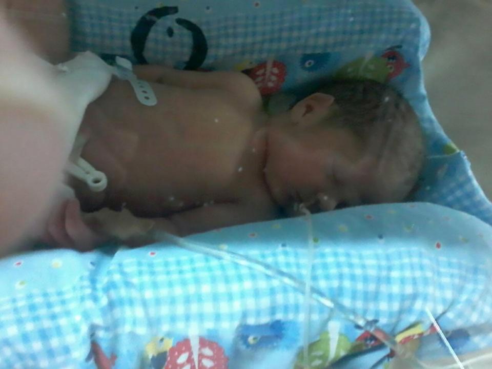 Melahirkan saat koma, wanita ini tersadar karena sang bayi