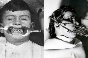 10 Alat kedokteran gigi jadul ini bakal bikin kamu merinding 