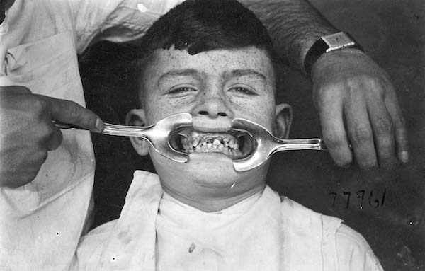 10 Alat kedokteran gigi jadul ini bakal bikin kamu merinding 