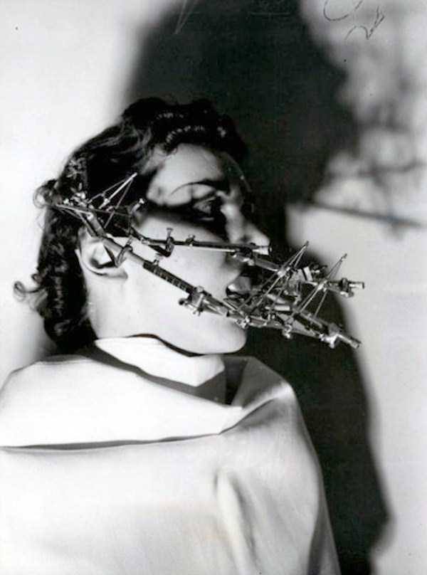 10 Alat kedokteran gigi jadul ini bakal bikin kamu merinding 