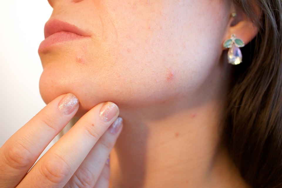 7 Tanda awal penyakit kanker kulit yang sebaiknya kamu ketahui