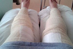 Wanita ini rajin mencukur rambut kemaluan, hasilnya malah bikin ngilu