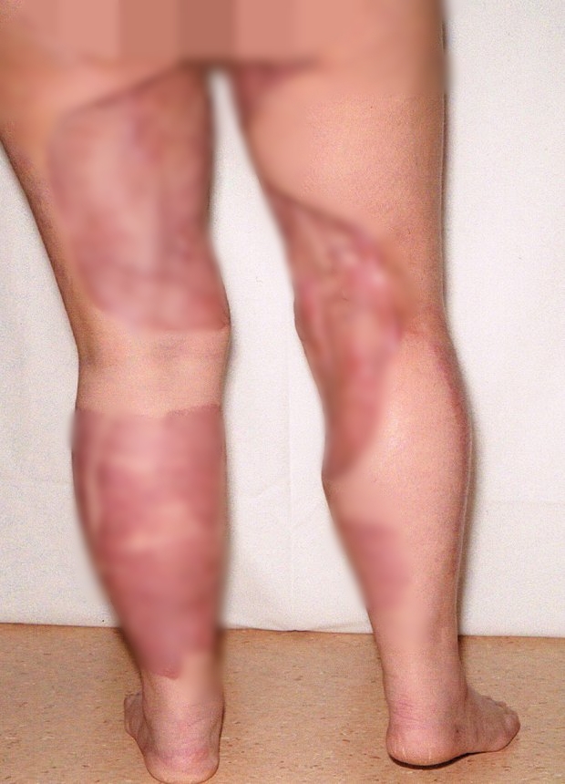 Wanita ini rajin mencukur rambut kemaluan, hasilnya malah bikin ngilu