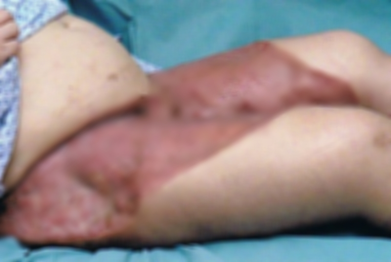 Wanita ini rajin mencukur rambut kemaluan, hasilnya malah bikin ngilu