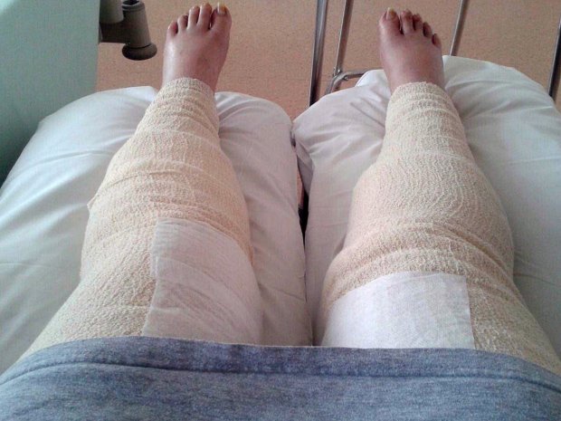 Wanita ini rajin mencukur rambut kemaluan, hasilnya malah bikin ngilu