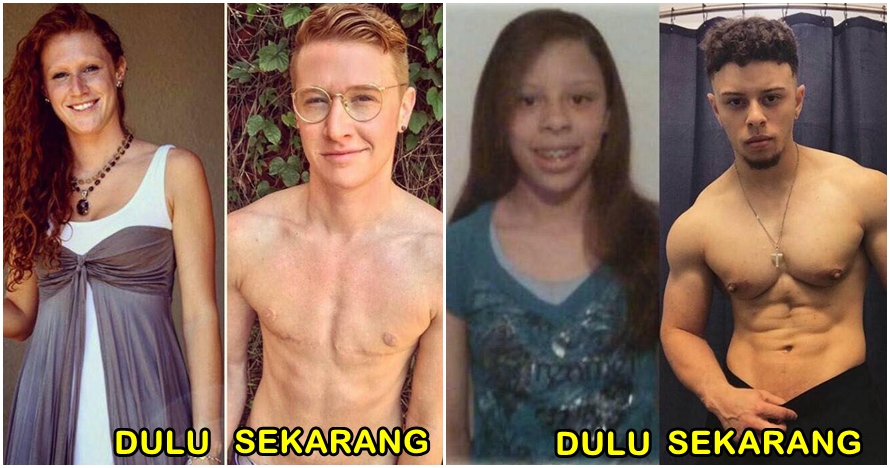 20 Foto perubahan transgender dari cewek ke cowok, mencengangkan