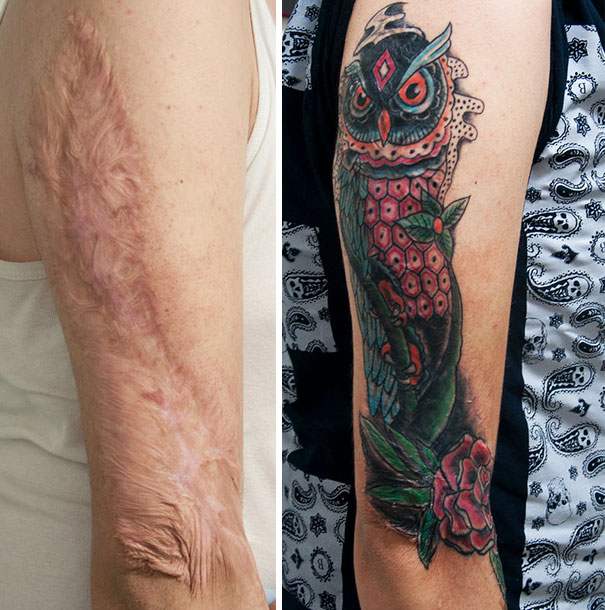 Kreatif maksimal, begini jadinya kalau bekas luka disulap jadi tato