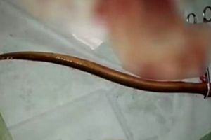 Tren memasukkan belut ke anus, alasannya bikin geleng-geleng kepala