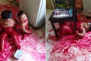 Orangtua ini lemas lihat keadaan anaknya, ternyata tak seburuk dugaan