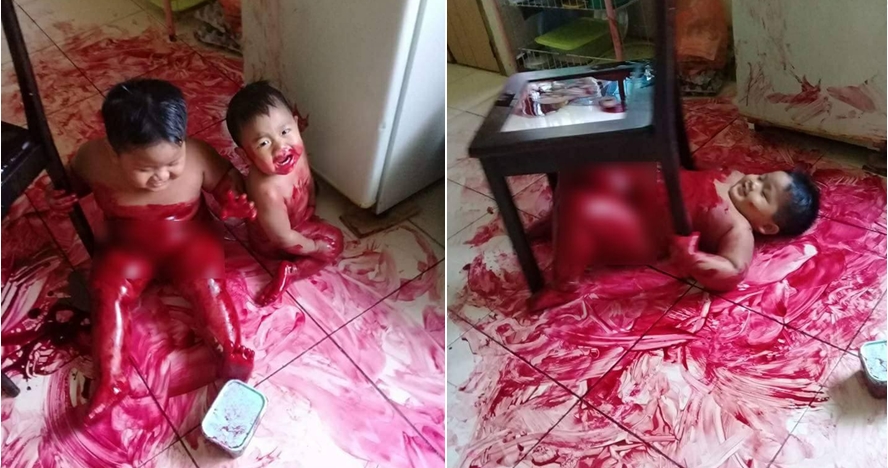Orangtua ini lemas lihat keadaan anaknya, ternyata tak seburuk dugaan