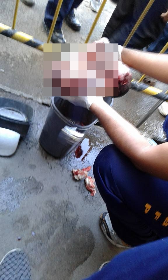 Tega banget orangtua ini, buang bayinya di tempat sampah