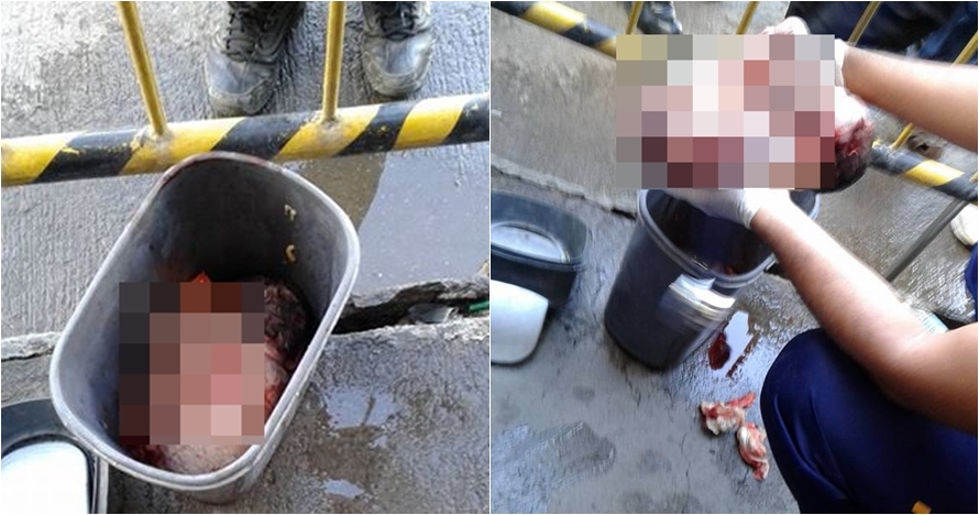 Tega banget orangtua ini, buang bayinya di tempat sampah