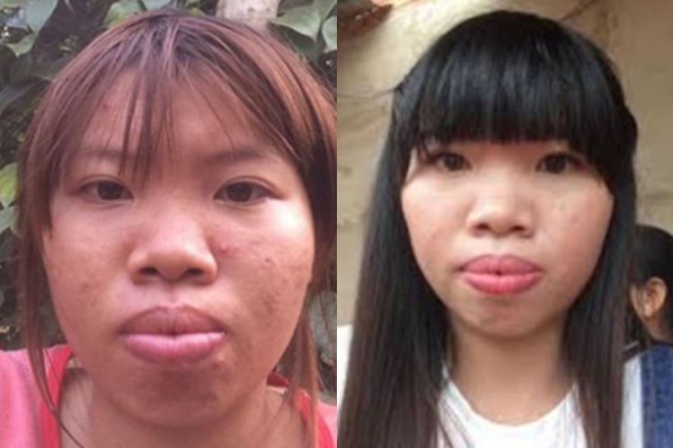 Transformasi cewek ini bikin kaget, dulu bak 'upik abu' kini memesona