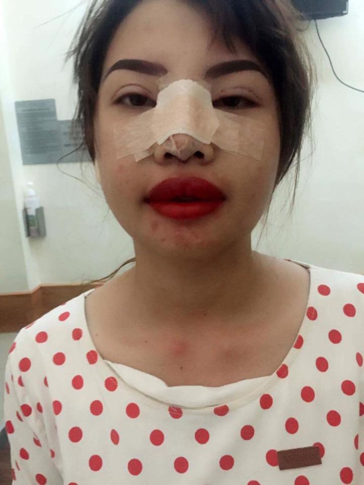 Transformasi cewek ini bikin kaget, dulu bak 'upik abu' kini memesona