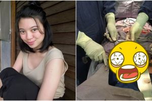 Nggak disangka, apa yang ditemukan dokter di tubuh wanita ini ngeri
