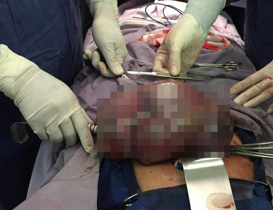 Nggak disangka, apa yang ditemukan dokter di tubuh wanita ini ngeri