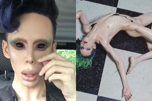 Ingin jadi alien tanpa kelamin, pria ini nekat jalani 110 kali operasi