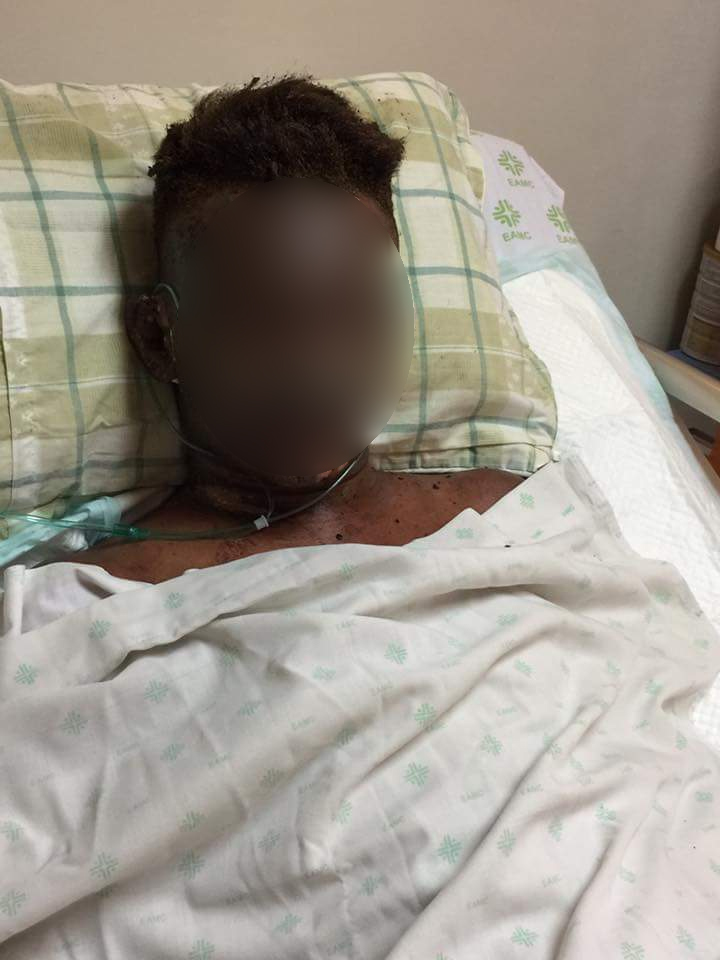 Niat rayakan ultah, keluarga ini merenggang nyawa karena gas meledak