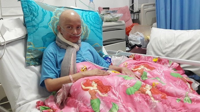 5 Artis Indonesia yang meninggal karena kanker payudara