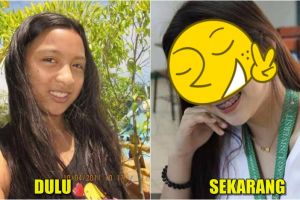 Beranjak dewasa, perubahan fisik gadis ini dijamin bikin pangling