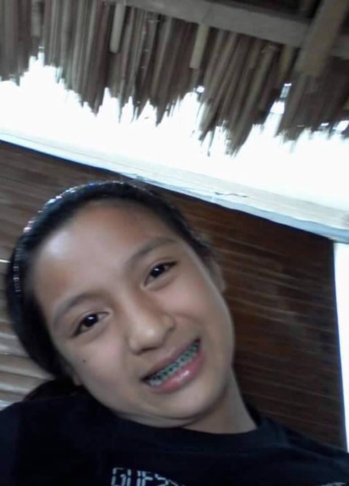 Beranjak dewasa, perubahan fisik gadis ini dijamin bikin pangling