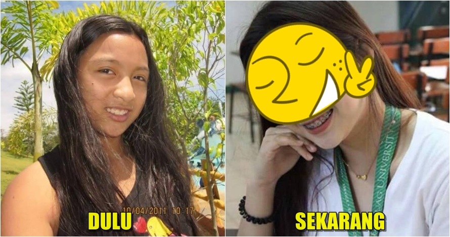 Beranjak dewasa, perubahan fisik gadis ini dijamin bikin pangling