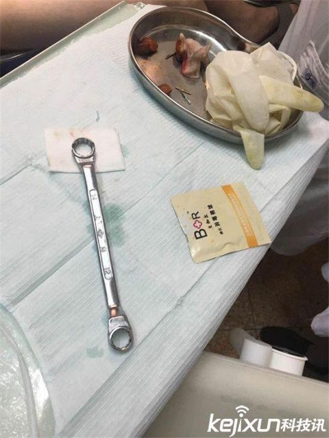 Mr P pria ini masuk kunci ring , yang bisa mencopot hanya dokter gigi