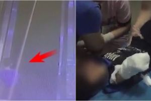 Lengan bocah 4 tahun ini terjepit eskalator di depan mata ibunya 