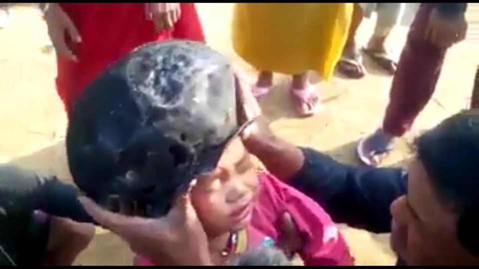  Kepala bocah ini kemasukan kwali, pas bisa dicabut malah dipukul