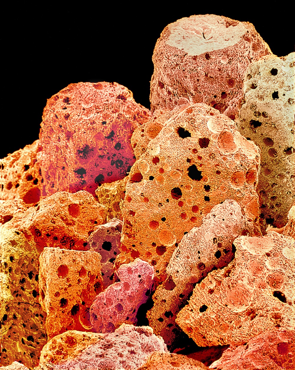 7 Foto melalui mikroskop makanan, menarik dipandang tapi menyeramkan