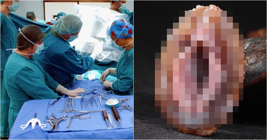 Putus asa melajang, pria ini berhubungan seks dengan tiram