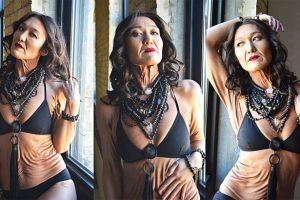 Berkulit gelambir, cewek ini buktikan semua bisa jadi model