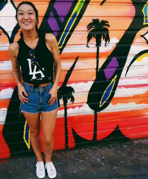 Berkulit gelambir, cewek ini buktikan semua bisa jadi model