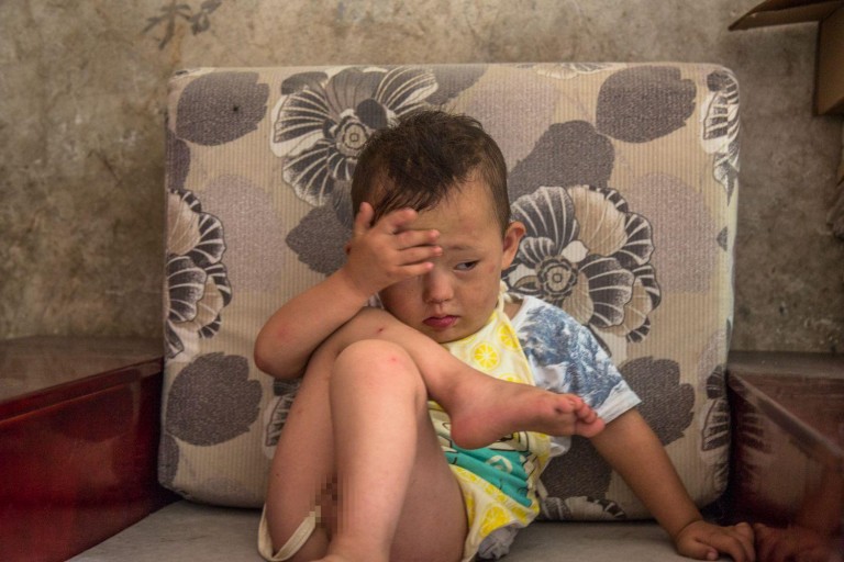 Kisah haru remaja banting tulang demi obati adiknya yang idap leukemia