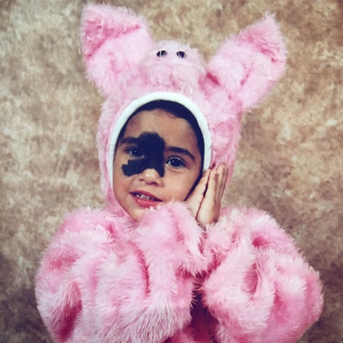 Dibully karena tanda lahir di wajah, cewek ini malah merasa cantik