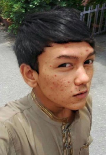 Transformasi wajah cowok ini jadi bahan cibiran netizen