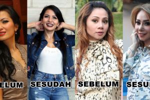 Perubahan 6 artis sebelum dan sesudah difiller, cantikan mana?
