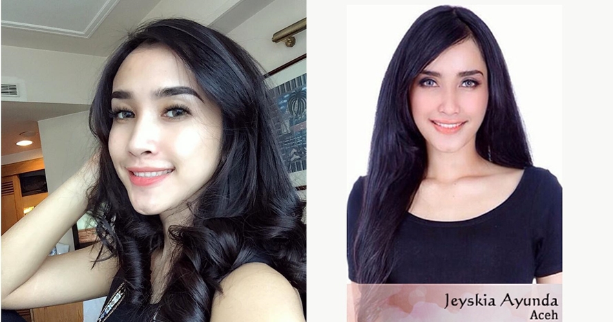 Jeyskia Ayunda, dokter cantik yang juga mantan finalis Putri Indonesia