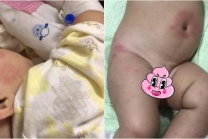 Kisah bayi salah diagnosis ini bikin para ibu harus waspada